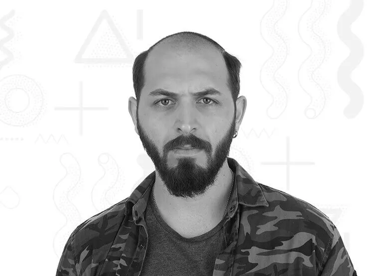Antalya Saç Protez Öncesi